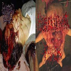 Emulsified Flesh : Emulsified Flesh - Erythrioblastosis Fetalis